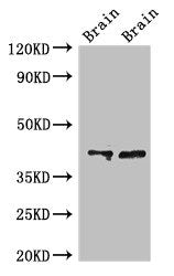 Western Blot Positive WB detected in: Rat brain tissue, Mouse brain tissue All lanes: CAMK1 antibody at 3ug/ml Secondary Goat polyclonal to rabbit IgG at 1/50000 dilution Predicted band size: 42 kDa Observed band size: 42 kDa