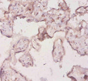 Immunohistochemistry of paraffin-embedded human placenta tissue using CSB-PA614514YA01HU at dilution of 1:20