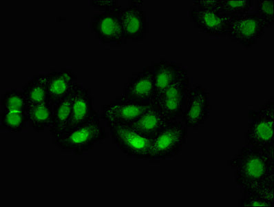 Immunofluorescent analysis of A549 cells using CSB-PA614520LA01HU at dilution of 1:100 and Alexa Fluor 488-congugated AffiniPure Goat Anti-Rabbit IgG(H+L)