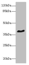 Western blot All lanes: GPR18 antibody at 8µg/ml + Mouse brain tissue Secondary Goat polyclonal to rabbit IgG at 1/10000 dilution Predicted band size: 39 kDa Observed band size: 39 kDa