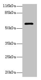 Western blot All lanes: GK3P antibody at 2µg/ml + Hela whole cell lysate Secondary Goat polyclonal to rabbit IgG at 1/10000 dilution Predicted band size: 61 kDa Observed band size: 61 kDa