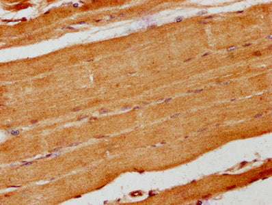 IHC image of CSB-PA614803LA01HU diluted at 1:200 and staining in paraffin-embedded human skeletal muscle tissue performed on a Leica BondTM system. After dewaxing and hydration, antigen retrieval was mediated by high pressure in a citrate buffer (...