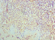 Immunohistochemistry of paraffin-embedded human tonsil tissue using CSB-PA614804ESR1HU at dilution of 1:100