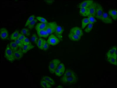 Immunofluorescence staining of HepG2 cells with CSB-PA614817LA01HU at 1:100, counter-stained with DAPI. The cells were fixed in 4% formaldehyde, permeabilized using 0.2% Triton X-100 and blocked in 10% normal Goat Serum. The cells were then incuba...
