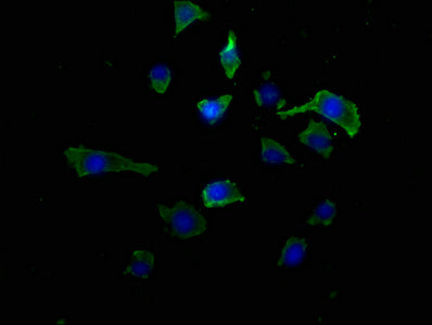 Immunofluorescence staining of SH-SY5Y cells with CSB-PA614818LA01HU at 1:50, counter-stained with DAPI. The cells were fixed in 4% formaldehyde, permeabilized using 0.2% Triton X-100 and blocked in 10% normal Goat Serum. The cells were then incub...
