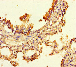 Immunohistochemistry of paraffin-embedded human lung tissue using CSB-PA614827LA01HU at dilution of 1:100