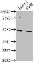 Western Blot Positive WB detected in: Jurkat whole cell lysate, K562 whole cell lysate All lanes: PSMD6 antibody at 1:2000 Secondary Goat polyclonal to rabbit IgG at 1/50000 dilution Predicted band size: 46, 42, 52 kDa Observed band size: 46 kDa