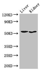 Western Blot Positive WB detected in: Mouse liver tissue, Mouse kidney tissue All lanes: SNX17 antibody at 3.5ug/ml Secondary Goat polyclonal to rabbit IgG at 1/50000 dilution Predicted band size: 53, 50 kDa Observed band size: 53 kDa