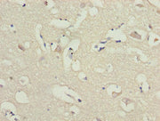 Immunohistochemistry of paraffin-embedded human brain tissue using CSB-PA614878LA01HU at dilution of 1:100
