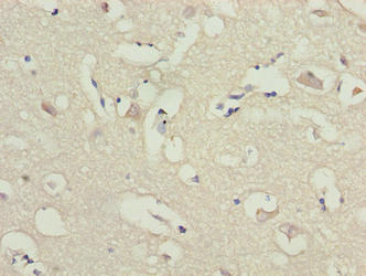 Immunohistochemistry of paraffin-embedded human brain tissue using CSB-PA614878LA01HU at dilution of 1:100