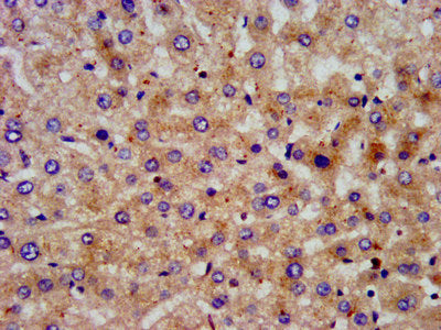 IHC image of CSB-PA614883LA01HU diluted at 1:200 and staining in paraffin-embedded human liver tissue performed on a Leica BondTM system. After dewaxing and hydration, antigen retrieval was mediated by high pressure in a citrate buffer (pH 6.0). S...