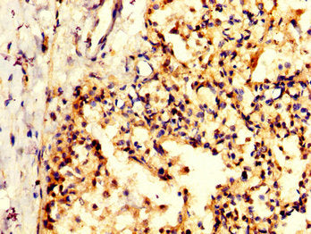 IHC image of CSB-PA614884LA01HU diluted at 1:200 and staining in paraffin-embedded human lung tissue performed on a Leica BondTM system. After dewaxing and hydration, antigen retrieval was mediated by high pressure in a citrate buffer (pH 6.0). Se...