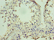 Immunohistochemistry of paraffin-embedded human testis tissue using CSB-PA614885ESR1HU at dilution of 1:100