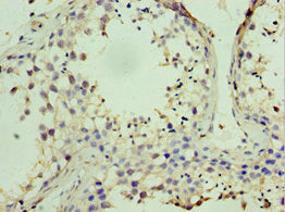 Immunohistochemistry of paraffin-embedded human testis tissue using CSB-PA614885ESR1HU at dilution of 1:100