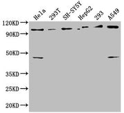 Western Blot Positive WB detected in: Hela whole cell lysate, 293T whole cell lysate, SH-SY5Y whole cell lysate, HepG2 whole cell lysate, 293 whole cell lysate, A549 whole cell lysate All lanes: RABEP1 antibody at 1:2500 Secondary Goat polyclonal...