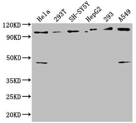 Western Blot Positive WB detected in: Hela whole cell lysate, 293T whole cell lysate, SH-SY5Y whole cell lysate, HepG2 whole cell lysate, 293 whole cell lysate, A549 whole cell lysate All lanes: RABEP1 antibody at 1:2500 Secondary Goat polyclonal...