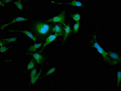 Immunofluorescence staining of Hela cells with CSB-PA614887LA01HU at 1:185, counter-stained with DAPI. The cells were fixed in 4% formaldehyde, permeabilized using 0.2% Triton X-100 and blocked in 10% normal Goat Serum. The cells were then incubat...