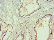 Immunohistochemistry of paraffin-embedded human prostate tissue using CSB-PA614890ESR2HU at dilution of 1:100