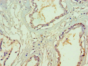 Immunohistochemistry of paraffin-embedded human prostate tissue using CSB-PA614890ESR2HU at dilution of 1:100