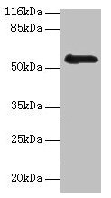 Western blot All lanes: RBMY1F antibody at 2µg/ml + PC-3 whole cell lysate Secondary Goat polyclonal to rabbit IgG at 1/10000 dilution Predicted band size: 56, 48 kDa Observed band size: 56 kDa
