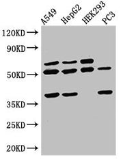 Western Blot Positive WB detected in: A549 whole cell lysate, HepG2 whole cell lysate, HEK293 whole cell lysate, PC-3 whole cell lysate All lanes: TAF1A antibody at 2.5µg/ml Secondary Goat polyclonal to rabbit IgG at 1/50000 dilution Predicted ban...