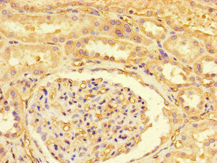 Immunohistochemistry of paraffin-embedded human kidney tissue using CSB-PA614898LA01HU at dilution of 1:100
