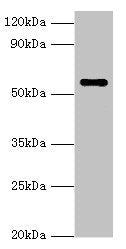 Western blot All lanes: NAB2 antibody at 3µg/ml + Hela whole cell lysate Secondary Goat polyclonal to rabbit IgG at 1/10000 dilution Predicted band size: 57, 35, 50 kDa Observed band size: 57 kDa
