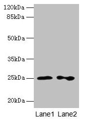 Western blot All lanes: RAB11B antibody at 2µg/ml Lane 1: Hela whole cell lysate Lane 2: Rat gonadal tissue Secondary Goat polyclonal to rabbit IgG at 1/10000 dilution Predicted band size: 25, 20 kDa Observed band size: 25 kDa