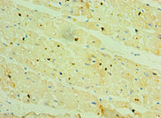 Immunohistochemistry of paraffin-embedded human heart tissue using CSB-PA614956ESR1HU at dilution of 1:100