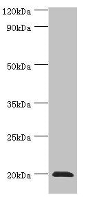 Western blot All lanes: Heat shock protein beta-2 antibody at 3ug/ml + Mouse skeletal muscle tissue Secondary Goat polyclonal to rabbit IgG at 1/10000 dilution Predicted band size: 20 kDa Observed band size: 20 kDa