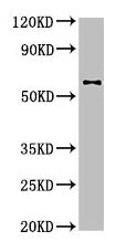 Western Blot Positive WB detected in: U87 whole cell lysate All lanes: DPYSL2 antibody at 4µg/ml Secondary Goat polyclonal to rabbit IgG at 1/50000 dilution Predicted band size: 63, 59 kDa Observed band size: 63 kDa