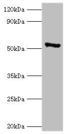 Western blot All lanes: CAMK4 antibody at 2µg/ml + 293T whole cell lysate Secondary Goat polyclonal to rabbit IgG at 1/10000 dilution Predicted band size: 52 kDa Observed band size: 52 kDa