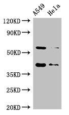 Western Blot Positive WB detected in: A549 whole cell lysate, Hela whole cell lysate All lanes: SMN1 antibody at 2µg/ml Secondary Goat polyclonal to rabbit IgG at 1/50000 dilution Predicted band size: 32, 29, 31, 28 kDa Observed band size: 40, 60 kDa