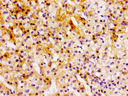 Immunohistochemistry of paraffin-embedded human adrenal gland tissue using CSB-PA614984LA01HU at dilution of 1:100
