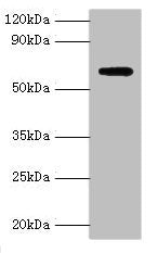 Western blot All lanes: Anti-Muellerian hormone type-2 receptor antibody at 15ug/ml + Mouse brain tissue Secondary Goat polyclonal to rabbit IgG at 1/10000 dilution Predicted band size: 63, 53, 52 kDa Observed band size: 63 kDa