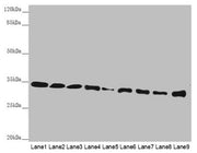 Western blot All lanes: HADH antibody at 2.38µg/ml Lane 1: Mouse heart tissue Lane 2: Mouse liver tissue Lane 3: Mouse kidney tissue Lane 4: Mouse skeletal muscle tissue Lane 5: NIH/3T3 whole cell lysate Lane 6: Hela whole cell lysate Lane 7: 293T...