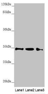 Western blot All lanes: HADH antibody at 1.21 ug/ml Lane 1: Mouse heart tissue Lane 2: Mouse liver tissue Lane 3: Mouse kidney tissue Secondary Goat polyclonal to rabbit IgG at 1/10000 dilution Predicted band size: 35, 43, 37 kDa Observed band siz...