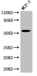 Western Blot Positive WB detected in: MCF-7 whole cell lysate All lanes: CYP51A1 antibody at 2.7µg/ml Secondary Goat polyclonal to rabbit IgG at 1/50000 dilution Predicted band size: 57, 47 kDa Observed band size: 57 kDa