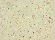 Immunohistochemistry of paraffin-embedded human smooth muscle tissue using CSB-PA615067LA01HU at dilution of 1:100