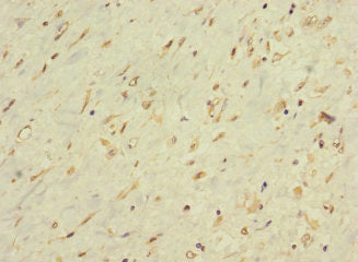 Immunohistochemistry of paraffin-embedded human smooth muscle tissue using CSB-PA615067LA01HU at dilution of 1:100