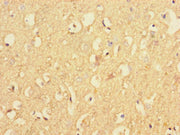 Immunohistochemistry of paraffin-embedded human brain tissue using CSB-PA615534LA01HU at dilution of 1:100