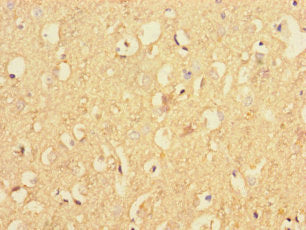 Immunohistochemistry of paraffin-embedded human brain tissue using CSB-PA615534LA01HU at dilution of 1:100