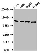 Western Blot Positive WB detected in: Hela whole cell lysate, A549 whole cell lysate, HepG2 whole cell lysate, Rat kidney tissue All lanes: NFATC3 antibody at 4.6µg/ml Secondary Goat polyclonal to rabbit IgG at 1/50000 dilution Predicted band size...