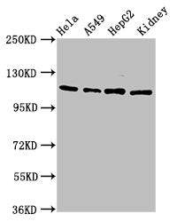 Western Blot Positive WB detected in: Hela whole cell lysate, A549 whole cell lysate, HepG2 whole cell lysate, Rat kidney tissue All lanes: NFATC3 antibody at 4.6µg/ml Secondary Goat polyclonal to rabbit IgG at 1/50000 dilution Predicted band size...