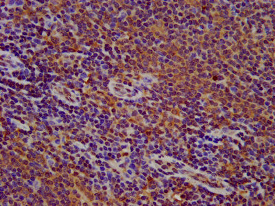 IHC image of CSB-PA615661LA01HU diluted at 1:500 and staining in paraffin-embedded human lymph node tissue performed on a Leica BondTM system. After dewaxing and hydration, antigen retrieval was mediated by high pressure in a citrate buffer (pH 6....