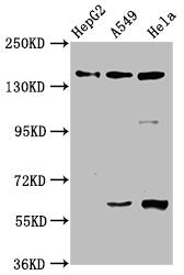 Western Blot Positive WB detected in: HepG2 whole cell lysate, A549 whole cell lysate, Hela whole cell lysate All lanes: NAIP antibody at 3.3µg/ml Secondary Goat polyclonal to rabbit IgG at 1/50000 dilution Predicted band size: 160, 142 kDa Observ...