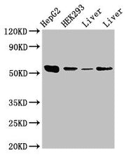 Western Blot Positive WB detected in: HepG2 whole cell lysate, HEK293 whole cell lysate, Rat liver tissue, Mouse liver tissue All lanes: MAP2K5 antibody at 3.5µg/ml Secondary Goat polyclonal to rabbit IgG at 1/50000 dilution Predicted band size: 5...