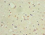 Immunohistochemistry of paraffin-embedded human brain tissue using CSB-PA615671DSR2HU at dilution of 1:100