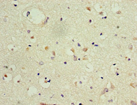 Immunohistochemistry of paraffin-embedded human brain tissue using CSB-PA615671DSR2HU at dilution of 1:100