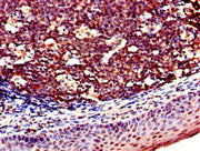 Immunohistochemistry of paraffin-embedded human tonsil tissue using CSB-PA615672LA01HU at dilution of 1:100